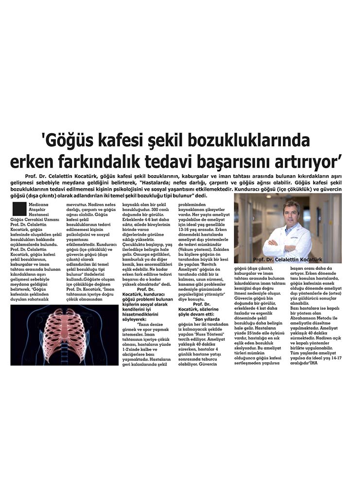 Göğüs kafesi şekil bozuklukları