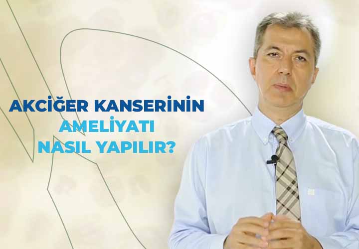 Akciğer Kanseri Ameliyatı Nasıl Yapılır?