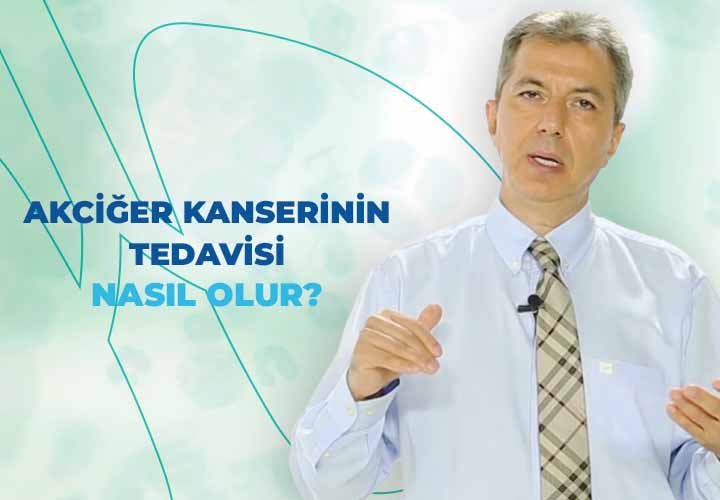 Akciğer Kanserinin Tedavisi Nasıl Olur? 